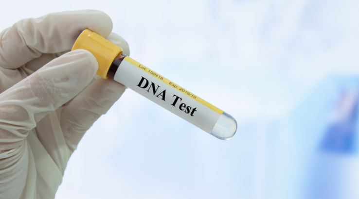 DỊCH VỤ XÉT NGHIỆM ADN Ở GÒ VẤP DỊCH VỤ XÉT NGHIỆM ADN Ở GÒ VẤP