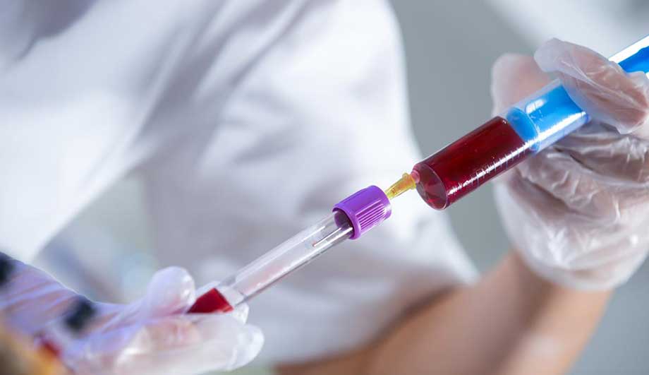 DỊCH VỤ XÉT NGHIỆM ADN Ở QUẬN 1 DỊCH VỤ XÉT NGHIỆM ADN Ở QUẬN 1