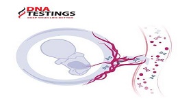 XÉT NGHIỆM SÀNG LỌC TRƯỚC SINH KHÔNG XÂM LẤN NIPT XÉT NGHIỆM SÀNG LỌC TRƯỚC SINH KHÔNG XÂM LẤN NIPT
