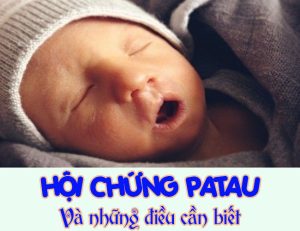 hoi chung patau trisomy 132