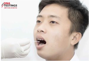 thu mau niem mac mieng