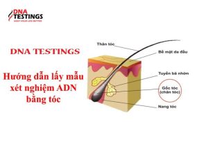 xet nghiem adn bang toc