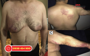 Hội Chứng Klinefelter: Thông Tin, Chẩn Đoán Và Cách Chăm Sóc 10 Hội Chứng Klinefelter: Thông Tin, Chẩn Đoán Và Cách Chăm Sóc