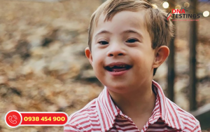 Hội chứng Jacobs XYY: Tổng quan về Tình trạng, Chẩn đoán và Điều trị 4 Hội chứng Jacobs XYY: Tổng quan về Tình trạng, Chẩn đoán và Điều trị