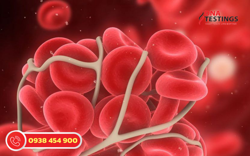 Hiểu Rõ Hơn Về Hội Chứng Thrombophilia Tăng Đông Máu