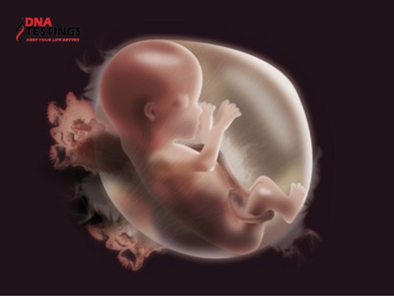 10 dị tật thường gặp ở thai nhi mẹ bầu nên chú ý