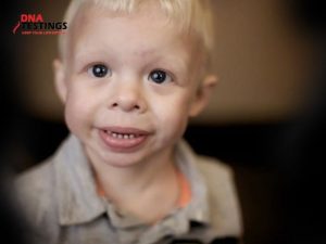 THÔNG TIN VỀ HỘI CHỨNG WILLIAMS - CÓ NGUY HIỂM KHÔNG? 4 THÔNG TIN VỀ HỘI CHỨNG WILLIAMS - CÓ NGUY HIỂM KHÔNG?