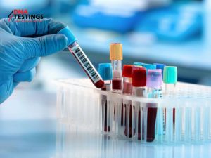 Tất tần tật về mẫu xét nghiệm ADN 10 mẫu xét nghiệm ADN
