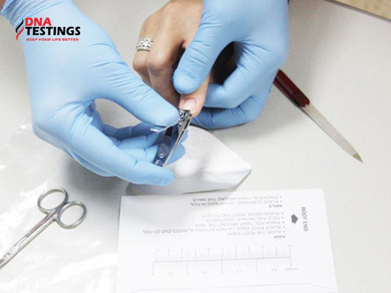 Quy trình lấy móng tay làm mẫu xét nghiệm ADN