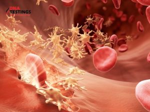 Tìm hiểu về xét nghiệm gen Hemophilia 11 Tìm hiểu về xét nghiệm gen Hemophilia