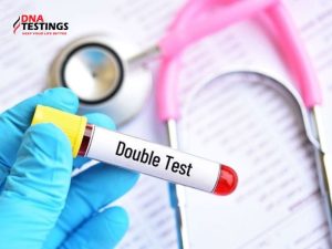 Không làm Double Test có sao không? Tìm hiểu nguy cơ và lợi ích của Double Test 10 Không làm Double Test có sao không