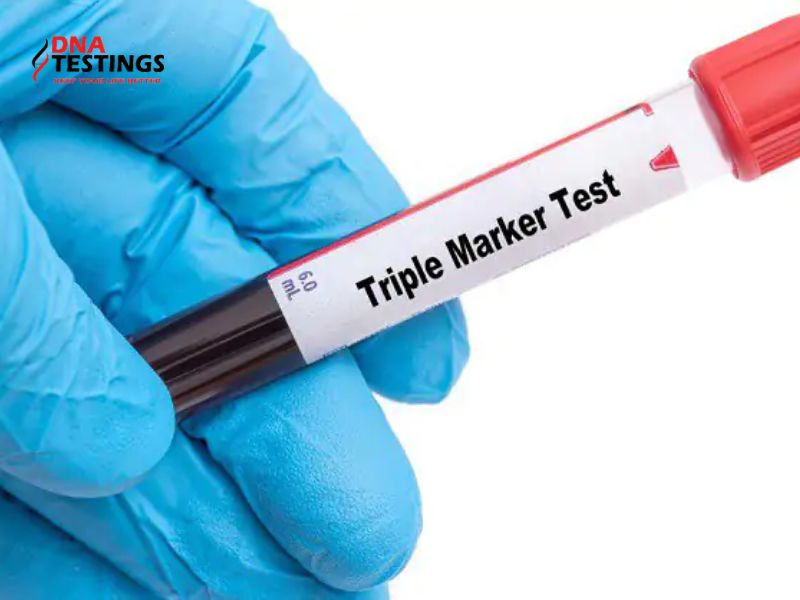 Xét nghiệm Triple Test là gì? Kết quả Triple Test thế nào là bình thường?