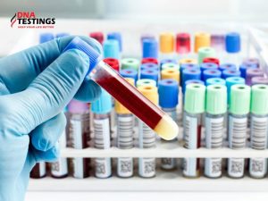 NIPT và Triple Test có gì khác nhau? Mẹ bầu nên làm xét nghiệm nào? 3 NIPT và Triple Test có gì khác nhau? Mẹ bầu nên làm xét nghiệm nào?