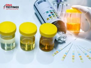 Có thể xét nghiệm ADN bằng mẫu nước tiểu được không? 7 Có thể xét nghiệm ADN bằng mẫu nước tiểu được không?