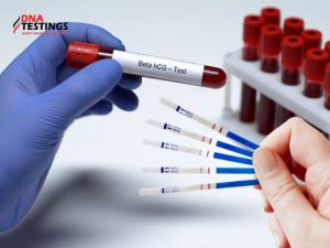 Tất tần tật về xét nghiệm Beta HCG 23 Tất tần tật về xét nghiệm Beta HCG