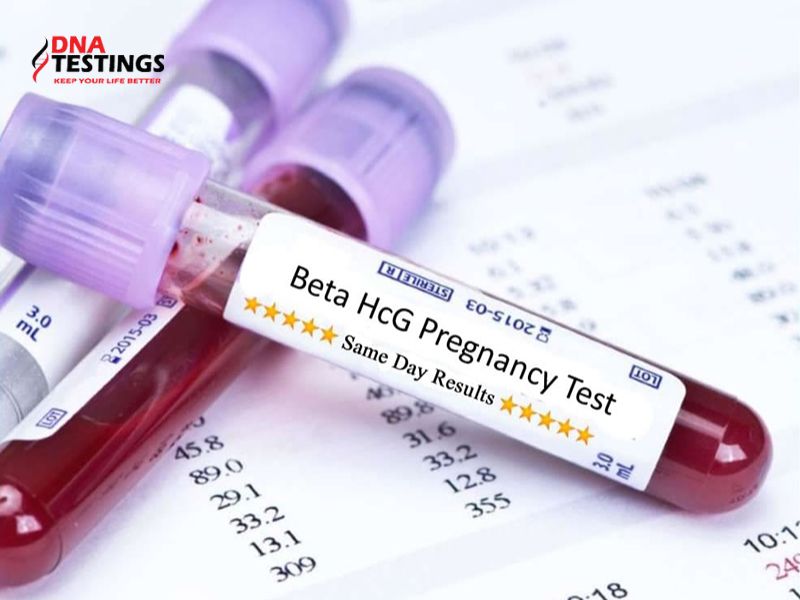 Tất tần tật về xét nghiệm Beta HCG