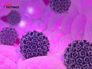 Tìm hiểu HPV type 52: Triệu chứng và điều trị 5 HPV type 52