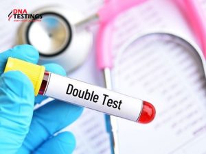 Hướng dẫn chi tiết quy trình xét nghiệm Double Test 10 quy trình xét nghiệm Double Test