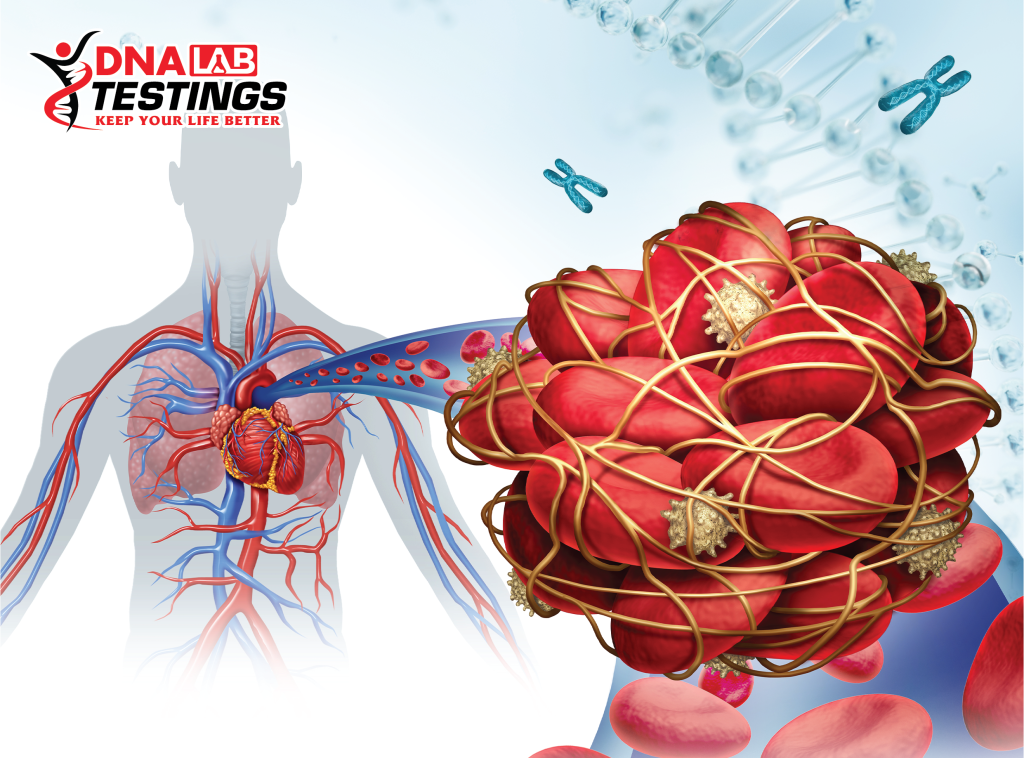 Xét Nghiệm Thrombophilia Là Gì? Giá Trị Trong Tầm Soát Sảy Thai Liên Tiếp 5 Thrombophilia 01