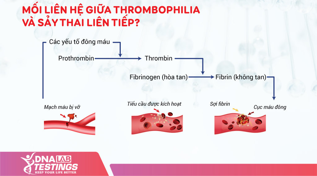 Xét Nghiệm Thrombophilia Là Gì? Giá Trị Trong Tầm Soát Sảy Thai Liên Tiếp 7 moi lien he xay thai Thrombophilia 02